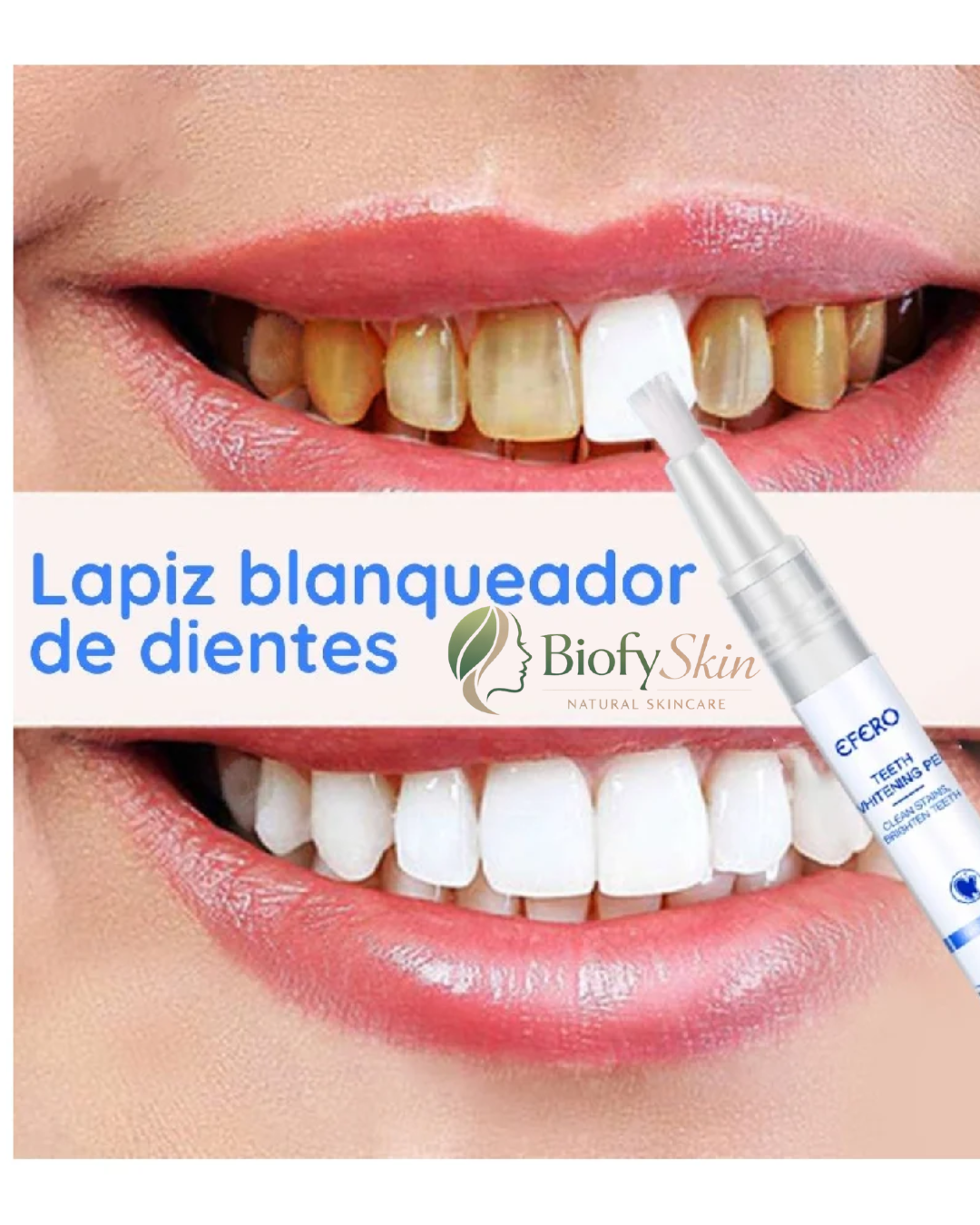 LÁPIZ BLANQUEADOR DENTAL DIENTES MÁS BLANCOS