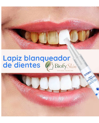 LÁPIZ BLANQUEADOR DENTAL DIENTES MÁS BLANCOS